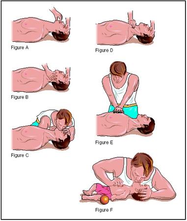 photo of cpr