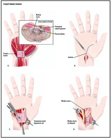 Inside The Hand